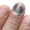 Black finger nail