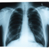 X-Ray.gif